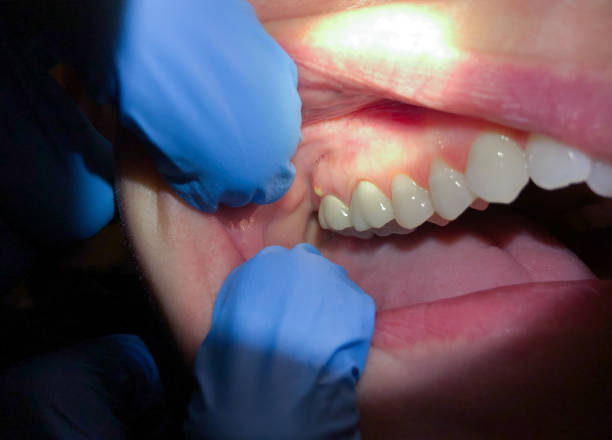 Best Pediatric Emergency Dentist in Mount Vernon, VA