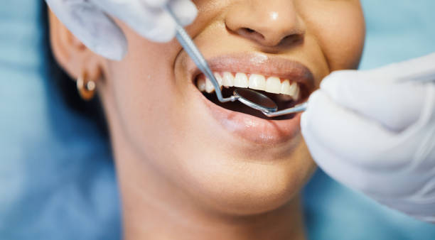 Best Emergency Wisdom Teeth Removal in Mount Vernon, VA