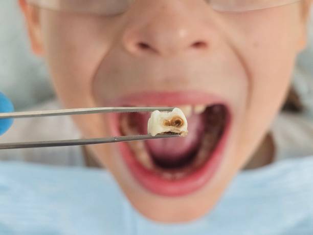 Best Weekend Emergency Dentist in Mount Vernon, VA